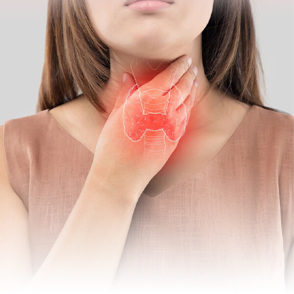 Thyroid Disorders