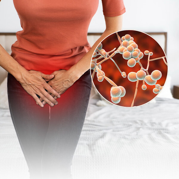 Vaginal Infections